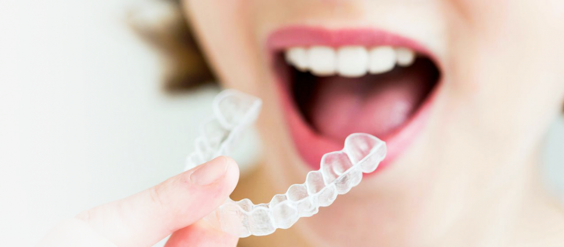 5. invisalign