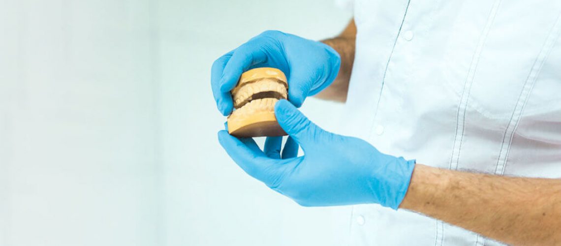 calidad en el material de un implante dental